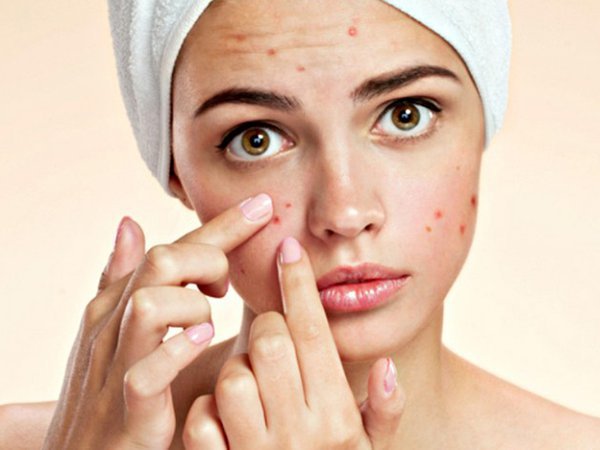 Bít tắc lỗ chân lông gây ra mụn