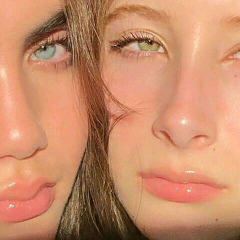 CÓ NÊN LỘT MỤN HAY KHÔNG? 