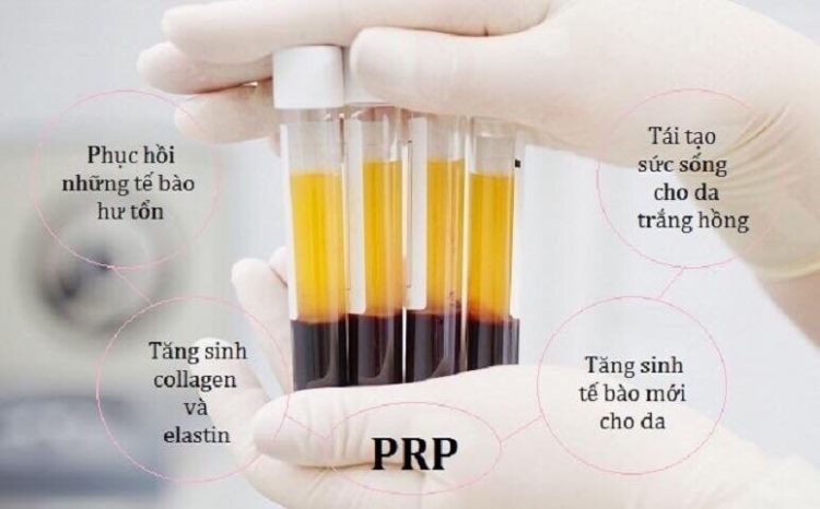 Mách Bạn Các Phương Pháp Điều Trị Sẹo Rỗ Tận Gốc