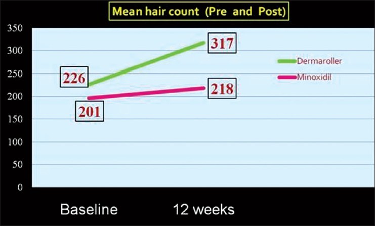 Lượng tóc trung bình của Nhóm Lăn Kim (đường màu xanh) tăng rõ rệt và nhiều hơn nhiều so với Nhóm Minoxidil (đường màu đỏ) sau 12 tuần thực hiện nghiên cứu