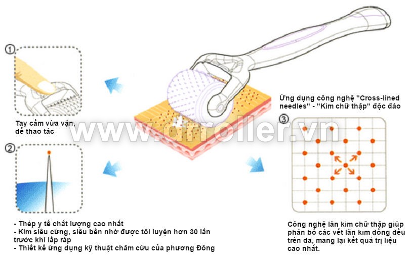 Dac tinh vuot troi cua kim lan Dr roller