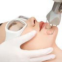 Mách Bạn Các Phương Pháp Điều Trị Sẹo Rỗ Tận Gốc
